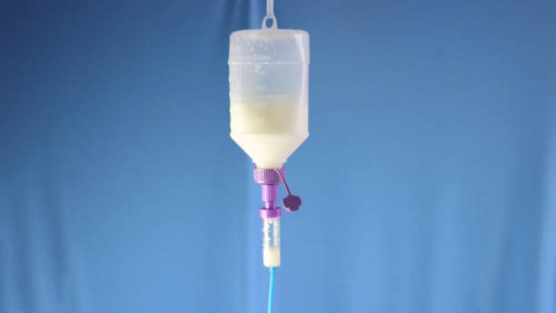 Frasco Alimentação Enteral: A Revolução na Nutrição de Pacientes! Frasco Alimentação Enteral: A Revolução na Nutrição de Pacientes!